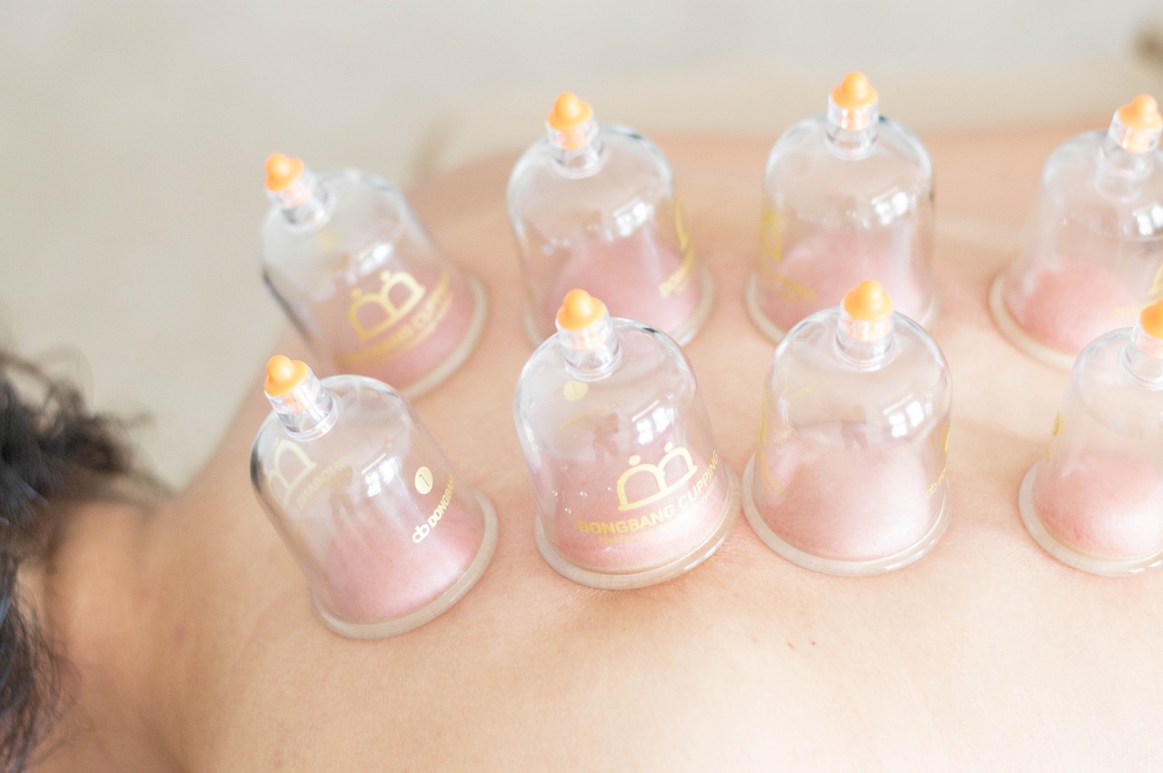 The effectiveness of Cupping Therapy in the Treatment of Shoulder Pain