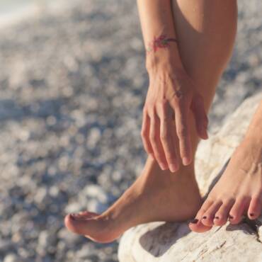 How to Treat Varicose Veins without Surgery? Everything you need to know