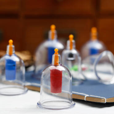 Beyond the hype: Can Cupping Therapy relieve Pain?