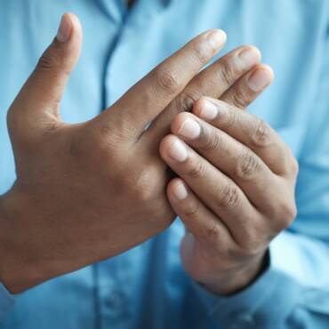 Cupping Therapy for Carpal Tunnel Syndrome: How it can help?