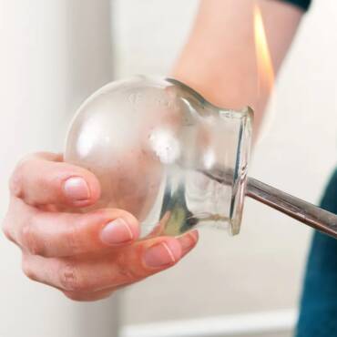 What Is Hijama Therapy? Benefits, Process, and What to Expect