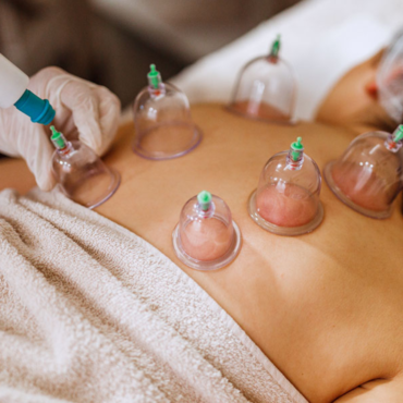 Cupping for Women: Hormonal Balance and Menstrual Relief
