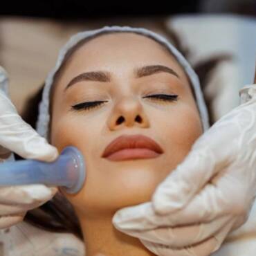 What Is Facial Cupping? The Natural Way to Healthier Skin