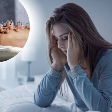 Can Hijama Help with Anxiety, Fatigue & Sleep Issues?