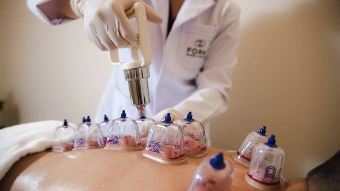 Hijama Around the World – How Different Cultures Use Cupping Therapy