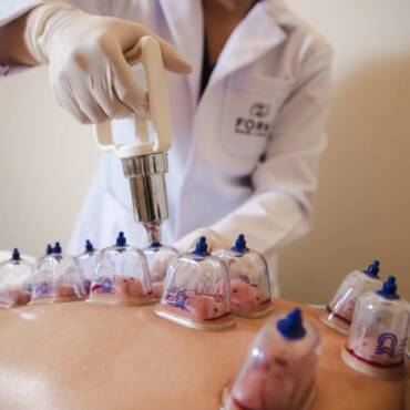 Hijama Around the World – How Different Cultures Use Cupping Therapy
