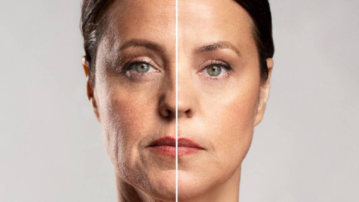 HydraFacial Anti-Aging Treatment: Reverse Fine Lines and Wrinkles Naturally