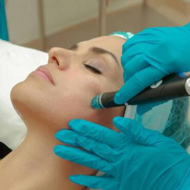 How Often Should You Get a HydraFacial for Best Results?